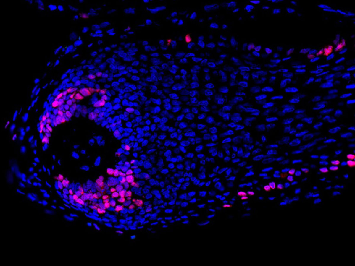 Human hair follicle organ culture - Monasterium Laboratory